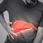 Early Signs of Liver Disease You Should Never Ignore
